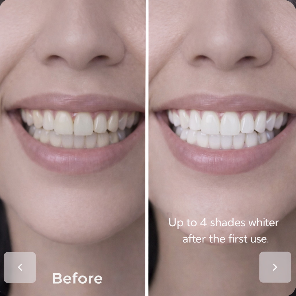 V34 Teeth Whitening Strips