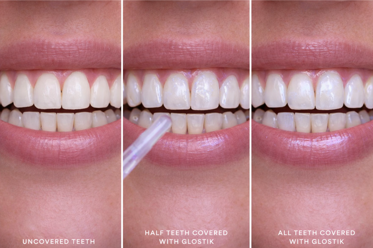 Teeth Whitening Gel Pen 4ml